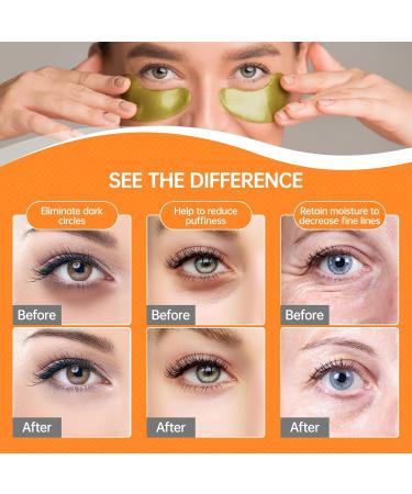 10 Pairs Hyaluronic Acid Eye Pads - Anti-Dark Circles & Anti-Wrinkle Patches with Collagen for Tired Eyes - Buy Online on GoSupps.com