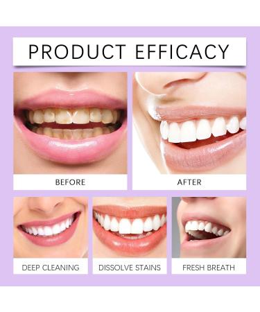 Fresh Mint Toothpaste - Gentle Daily Cleaning Removes Stains Freshens Breath Nourishes Gums Keeps Teeth Bright & Clean(2PCS) - Buy Online on GoSupps.com