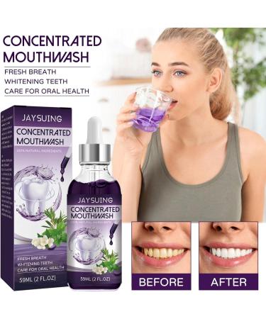 Ailopta Mouthwash for Bad Breath | 59ml Cool Mint Alcohol-Free No Dyes or Sweeteners - Buy Online on GoSupps.com