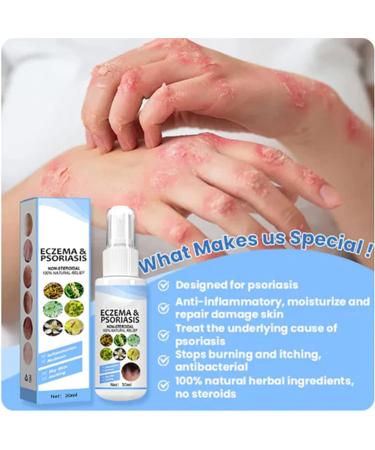 Xunnisa Meellop Herbal Psoriasis Relief Spray - Natural 30ml Soothing Treatment for All Skin - Buy Online on GoSupps.com