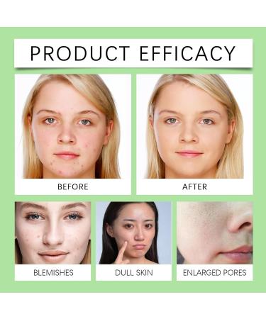 Nettoyant Visage Moussant L'aloe Vera - Nettoie En Douceur Les Pores Hydrate (sans Tiraillements) limine Impuret s L'acn Et Points Noirs For Une Peau Nette(3PCS) - Buy Online on GoSupps.com
