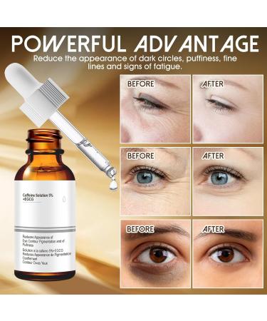 Serum Yeux Contour des Yeux Anti Rides Cafeine Contour des Yeux Caf ine 5% + Egcg serum Contour des Yeux serum yeux Anti Cernes et Poche limine les Poches Sous les yeux - Buy Online on GoSupps.com