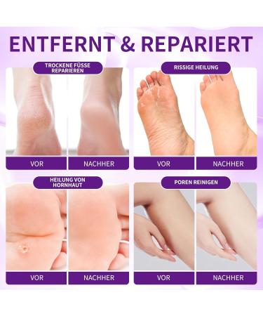 Revitalize Your Feet with Lavender Foot Peel Mask | Corneal Removal & Spa Pedicure Set for Soft Smooth Skin - International Shipping Available - Buy Online on GoSupps.com