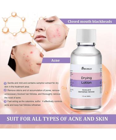 SIRUIMAO Stubborn Acne Drying Lotion - Overnight Acne Spot Treatment for Face & Body - 1 Fl Oz (Pack of 1) - Buy Online on GoSupps.com
