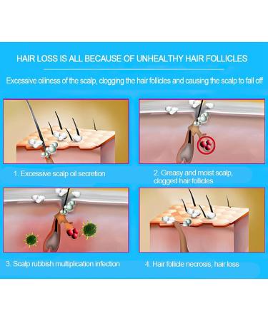 Mavdecll Hair Growth Cap Professional Light Therapy Helmet for Hair Regrowth and Hair Loss Treatment Hair Growth System - Buy Online on GoSupps.com