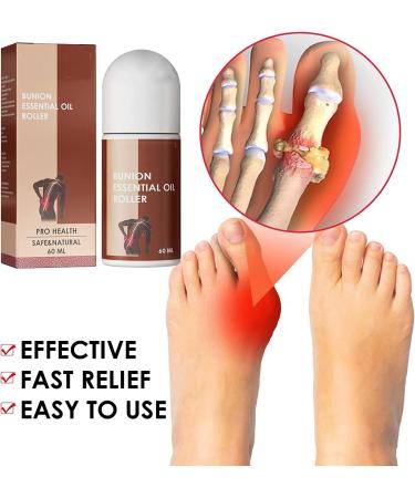 AAOCLO 2pcs Anti Bunion Treatment Oil Pain Relief Roller - Foot Care Corrector for Women & Men - Pro Health Solution - Buy Online on GoSupps.com