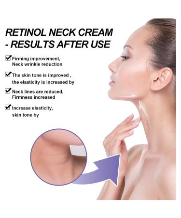 WOAILIANGEJINJIN 2pcs Neck Firming Creams for Tightening and Wrinkle Reduction Lifting & Skin Tightening Moisturizer for Face Neck & D collet Deep Hydrationn40G/1.41OZ - Buy Online on GoSupps.com