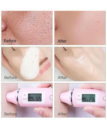 Aloe Vera Face Wash | Gentle Exfoliating Cleanser for Deep Pore Cleansing | Hydrating Facial Foam for Dry Skin | International Shipping Available - Buy Online on GoSupps.com