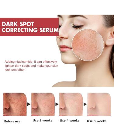 Dark Spot Correcting Serum Peach 70% Niacinamide Serum for Acne Scars Post-Acne Marks Korean Skincare Set for Teenagers Adult - Buy Online on GoSupps.com