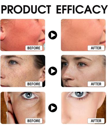 Hyaluronic Acid Sunscreen SPF 50+ PA+++ Sun Cream SPF 50 Face Sunscreen SPF 50 High Protection Face Sun Cream Moisturizing Refreshing Travel Size Sun Cream Against Sunburn Non-Greasy - Buy Online on GoSupps.com