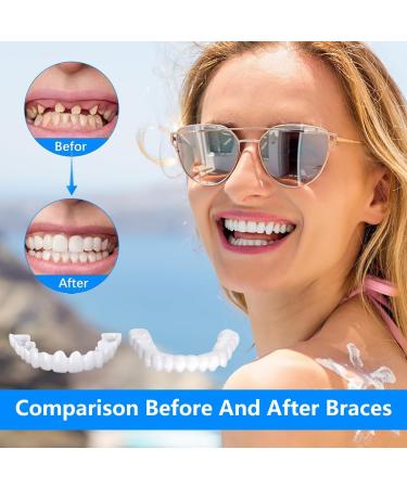 Shop Dazluxe: 2 Pairs of Snap-On Artificial Teeth & Veneers for a Perfect Smile Ideal for Braces! - Buy Online on GoSupps.com