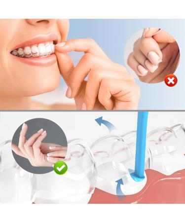 Aligner Removal Tool 5 Invisible Braces Removal Tools Retainer Remover Tool Suitable for Removing Braces Trays Retainers Dentures and Aligners(Blue). Regular size B 5pcs Light blue - Buy Online on GoSupps.com