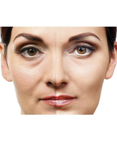 Eyesential 20ml Bottle: Removes Wrinkles, Puffiness, Dark Circles - Back in Stock - Buy Online on GoSupps.com