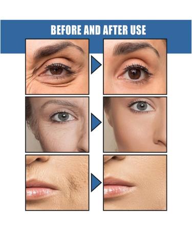  GNAUMORE Instant 5-second anti-wrinkle cream effective anti-aging whitening moisturizer reduces fine lines and wrinkles for men and women 30 ml - Buy Online on GoSupps.com