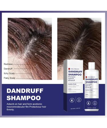 SHEBEEDO Folliculitis Itch Relief Shampoo Anti Dandruff Shampoo Seborrheic Dermatitis Shampoo Dandruff Scalp Treatment Itchy Scalp Shampoo For Dry Scalp - Buy Online on GoSupps.com