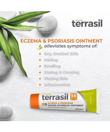 Terrasil Eczema and Psoriasis Cream | Calendula & Natural Ingredients | Eczema Relief for Severe Outbreaks | Soothes Rashes & Rosacea | Repairs Dry, Itchy Skin | 28g - Buy Online on GoSupps.com