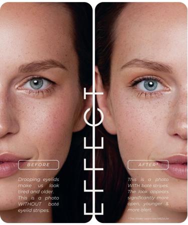 BOT discrete & breathable eyelid lifting tape (144xS) - eyelid strips for radiant eyes - adhesive eyelid tape with mechanical effect lifting tape for eyelids instead of surgery eyelid lifter strips 144x S - Buy Online on GoSupps.com