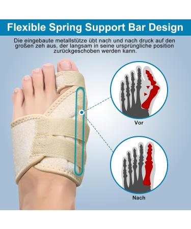 Hallux Valgus Correction Rail - Big Toe Pain Relief & Toe Alignment Bandage for Men & Women (Beige Right) - Buy Online on GoSupps.com