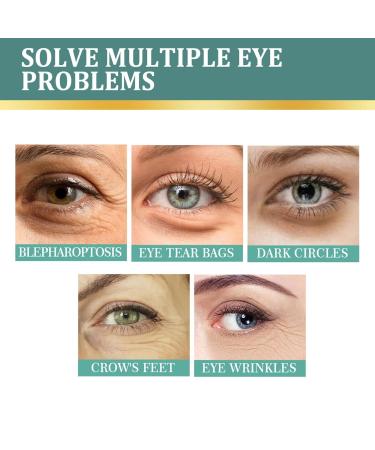 Jasmine Ointment Eye Cream for Dark Circles & Wrinkles - 100ml with Collagen & Aloe Vera - Buy Online on GoSupps.com