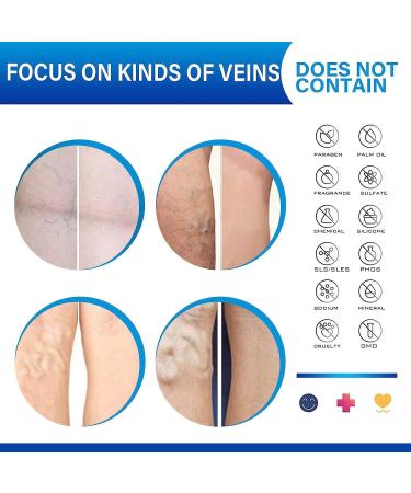 Varicose Veins Relief Cream - Fast Treatment for Legs | Improve Blood Circulation | Phlebitis & Angiitis Inflammation Relief - Buy Online on GoSupps.com