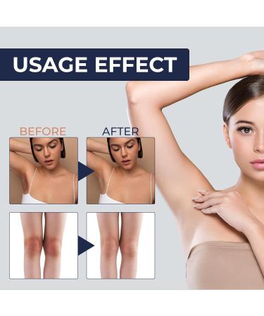 Dark Spot Remover Cream for Intimate Areas | Target Discoloration on Inner Thighs Armpits Elbows & More | Glycerin Citric Acid & Chrysin | Made in Italy - Buy Online on GoSupps.com