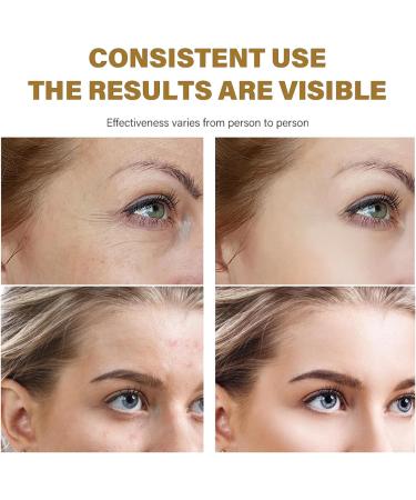  Jesshiny Instant Lifting Anti-Wrinkle Roll-On Serum 10ml Firming Facial Oil with Hyaluronic Acid and Vitamin E Instant Lifting Firming and Hydrating Effect Roll-On - Buy Online on GoSupps.com