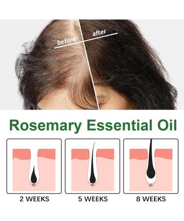 JPSDOWS Pure Rosemary Oil - Hair Oil for Smooth Hair 4.22 fl oz. Oz Advanced Organic Nourishing Rosemary Essential Oil for Thinning Hair and Scalp Jpsdows - Buy Online on GoSupps.com