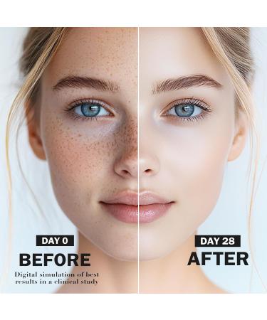 Dark Spot, Dark Spot Remover for Face and Body with Niacinamide & Alpha-Arbutin | Serum for Age Spots, Sun Spots, Melasma | All Skin Types, Men & Women 1 Fl Oz (Pack of 1) - Buy Online on GoSupps.com