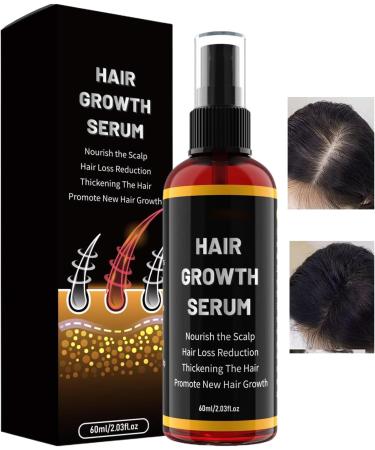 Huile capillaire - 60 ml - Huile de croissance des cheveux - Produit nourrissant - Huiles de renforcement des cheveux pour femmes et hommes - Voyage la maison - Pour les amateurs de beaut  - Buy Online on GoSupps.com