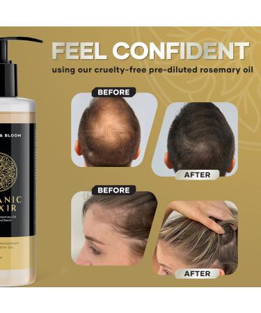 Rosemary Oil For Hair Growth Natural Serum with Biotin Sunflower Oil Argan Oil and Rosemary Oil Natural Hair Growth Oil with Pre Diluted Rosemary Oil for Hair Growth - Buy Online on GoSupps.com