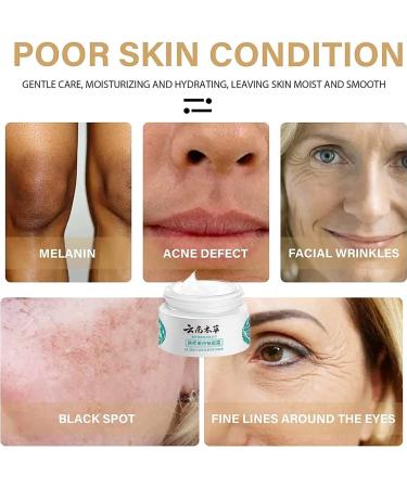 Peehss Dr HANCY Yunnan Herbal Whitening Cream - Fades Spots, Brightens Skin Tone, Japanese Melasma Cream (2PCS) - Buy Online on GoSupps.com