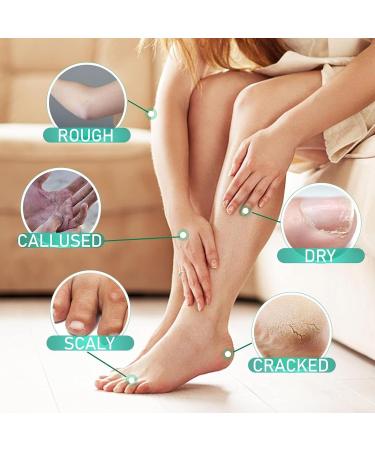 Urea Foot Cream Foot Cream for Cracked Heels and Dry Skin Cracked Heel Repair Cream Callus Remover Foot Moisturiser Natural Moisturizes Nourishes Softens Hand & Feet Care - Buy Online on GoSupps.com