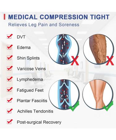 Beaister Medical Compression Stockings for Women & Men - 20-30 mmHg Support Stockings for Varicose Veins & Edema - Opaque Toe Wrap - XXL Brown - Buy Online on GoSupps.com