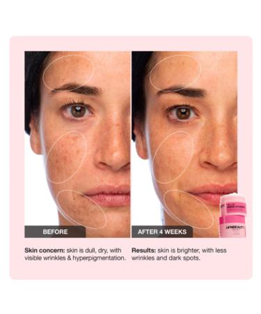 Innbeauty Project 10+10 Daily Moisturizer with 10% Vitamin C + 10% Peptide Complex + Ceramides 1.7 OZ (50ml) 1.7 Fl Oz (Pack of 1) - Buy Online on GoSupps.com