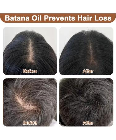 Batana Oil for Hair Growth 100% Pure Organic Raw Batana Oil as Hair Mask Scalp and Hair Oil Repairs Damaged Hair & Skin Nourishes Thin Hair Scalp Skin Reduces Hair Loss 120g/4.2oz Miracle Hair Oil - Buy Online on GoSupps.com