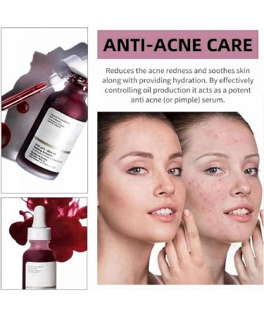 AHA 30%+BHA 2% Face Serum AHA Serum for Hydrated BHA Exfoliating Solution Hyalu B5 Serum AHA &BHA Serum to Reduce Fine Line and Minimise Pore Facial Serum Dark Spot Remover for Face Brightening Serum - Buy Online on GoSupps.com