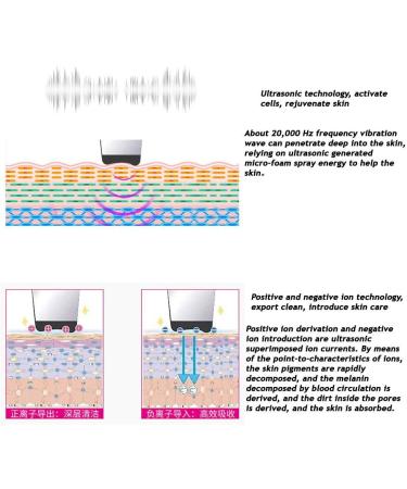 Ultrasound Rechargeable Scrubber Spatula Blackhead Removal Pore Cleaner for - Buy Online on GoSupps.com