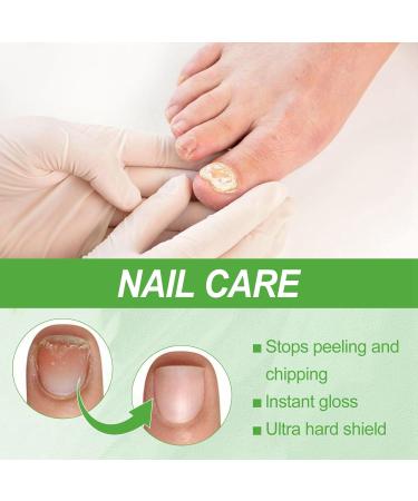 Keratin 3 Day Growth Nail Treatment & Strengthener Nail Growth Treatment for Nail Strengthener Fast Keratin Nail Hardener Nail Repair Treatment for Thin Nails Strengthening Nail Polish Nail Serum - Buy Online on GoSupps.com