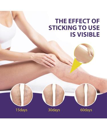 Varicose Veins Cream Spider Vein Cream Varicose Veins Treatment for Legs Spider Veins Treatment Cream Vein Cream for Legs Spider Veins Repair Cream Varicose Veins Ointment Aching Legs Relief - Buy Online on GoSupps.com
