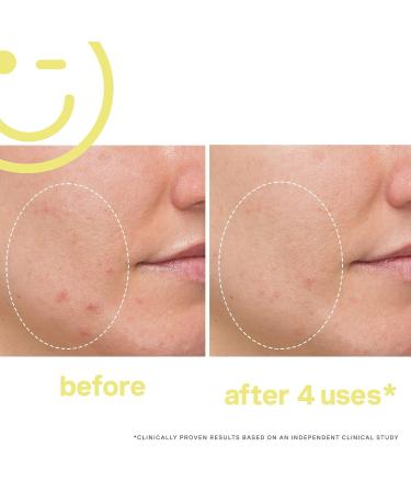 Kate Somerville Mega-C 30% Vitamin C Brightening Facial Mask - 2 Fl Oz - Buy Online on GoSupps.com