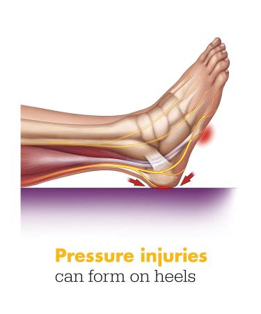 Sage Prevalon Heel Protector II - Pressure Relief for Heels (2 Pack) - Buy Online on GoSupps.com