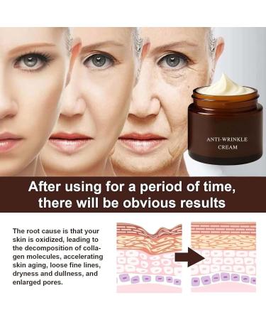  Generisch Luxeveria Retinol 2-Pack Anti-Aging Day Creams: Luxeveria anti-wrinkle magic cream reduces fine lines and dryness wrinkles moisturizing facial care for all skin types - Buy Online on GoSupps.com