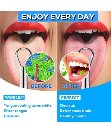 Professional Tongue Scraper for Bad Breath | Portable Tongue Cleaner with Case | Dental Care Tool for Adults & Children | 3-Piece Set - Buy Online on GoSupps.com