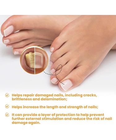 Fungal Nail Treatment Nail Repair Patches Restores Damaged Nails Nail Fungus Treatment for Toenail Gently Effectively Nail Care Anti Fungal Repair Patches Restores Healthy Nails - Buy Online on GoSupps.com