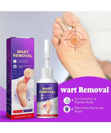 20ml Corn Removal Liquid - Callus, Corn, Wart & Skin Tag Remover for Feet - Buy Online on GoSupps.com