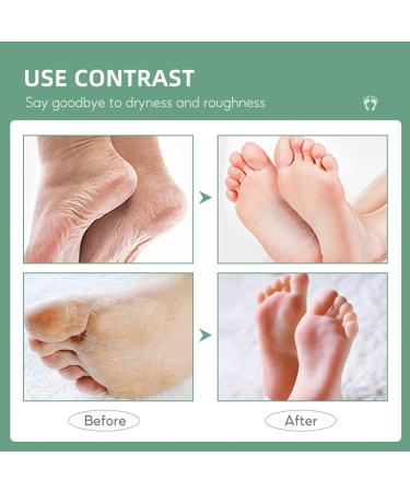 Urea 40% Foot Cream Tea Tree Urea Foot Cream Urea Foot Cream 40% Cracked Heel Repair Cream 40% Urea Cream Intensive Exfoliating Foot Cream Foot Cream for Cracked Heels and Dry Skin - Buy Online on GoSupps.com