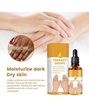 NigriCare Acanthosis Therapy Drops Nigricans for Neck Hands Elbows Dark Spots Pack of 2 - Buy Online on GoSupps.com