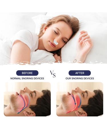 Buy Anti Snoring Devices | Twin Turbine Electric Snore Stopper for Men & Women - Effective Snoring Prevention - Buy Online on GoSupps.com