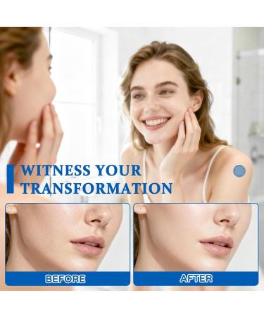 NAD+ Patches for Women and Men, NAD+Patch for Energy and Healthy Aging, Nicotinamide and Resveratrol Wellness Support, Vegan, 30 Patches 30 Count - Buy Online on GoSupps.com