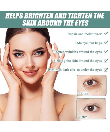 1 Pcs Jasmine Eye Cream Jasmine Ointment For Dark Circles Jasmine Active Ointment Jasmine Eye Cream Reduces Dark Circles Fine Lines Bags And Wrinkles Under The Eyes - Buy Online on GoSupps.com